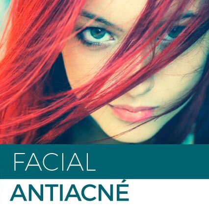Tratamiento facial antiacné